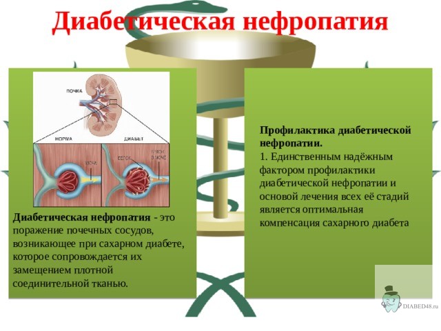 Диабетическая нефропатия: как защитить свои почки от поражения?